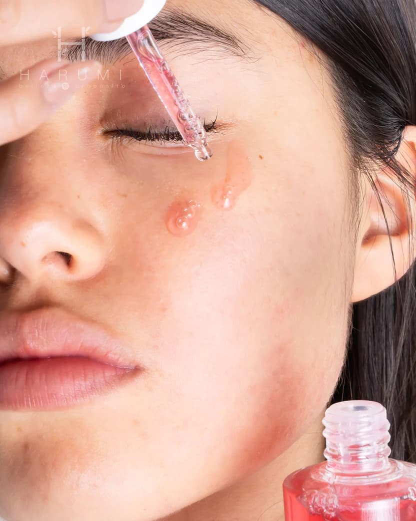 Anua Niacinamide 10 Txa 4 Serum thumbnail